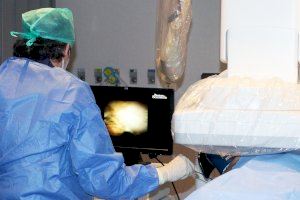 El Hospital General de València emplea una nueva técnica para el tratamiento de cálculos en las vías biliares