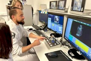 Un hospital de Elche instaura una técnica para tratar el cáncer de mama izquierda que permite irradiar la zona sin afectar al corazón