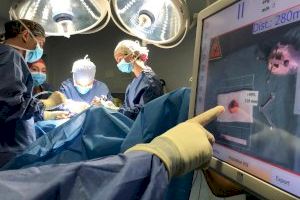 El Peset, primer hospital público español en aplicar una técnica innovadora de cirugía radioguiada para el cáncer