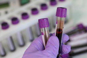 ¿En qué consisten los test rápidos para el diagnostico del coronavirus?