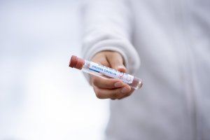 La española Oryzon ultima un fármaco para tratar a enfermos en coronavirus