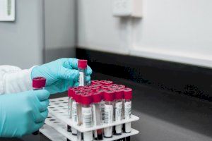 Un estudio piloto con sello valenciano utilizará los avances en oncología para luchar contra el coronavirus