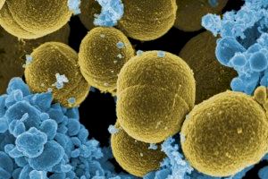 Descubren un mecanismo que regula la actividad patogénica de la bacteria Staphylococcus aureus