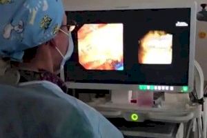 El hospital de Gandia incorpora un endoscopio de última generación que evitará realizar cirugías