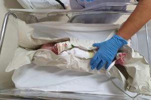 El Hospital General Universitario de Elche consolida una técnica pionera en la Comunitat Valenciana para hacer resonancias a bebés