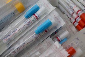 España realiza más de 7,6 millones de PCR desde el inicio de la pandemia