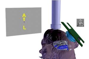 La UMH colabora en el desarrollo de una neuroprótesis con más de mil electrodos para ayudar a personas ciegas a percibir formas y letras