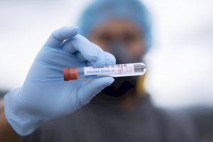 España ha realizado más de 29,9 millones de pruebas diagnósticas desde el inicio de la epidemia