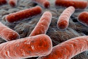 Un estudio del CSIC revela que las infecciones múltiples son comunes en tuberculosis multirresistente