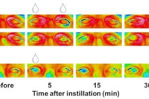 El laboratorio de Neurobiología Ocular de la UMH explica cómo funciona una lágrima artificial para el ojo seco