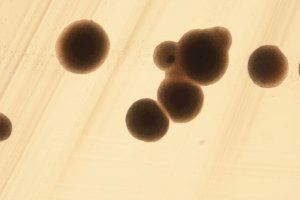  Foto al microscopio de una colonia de Saccharomyces uvarum
