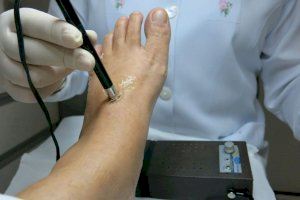 Ocho afecciones comunes en los pies de pacientes oncológicos