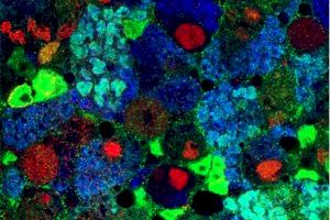 Descobreixen un nou regulador de la proliferació cel·lular en el sistema nerviós