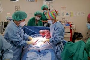 El Hospital de Gandia permite el acompañamiento en cesáreas y partos instrumentados