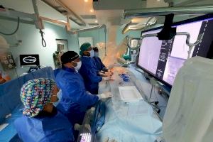 El Hospital Dr. Balmis realiza cerca de 250 tratamientos endovasculares contra el ictus isquémico en el último año