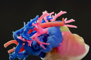 Así se imprimen copias 3D de los órganos humanos para practicar antes de una cirujía complicada