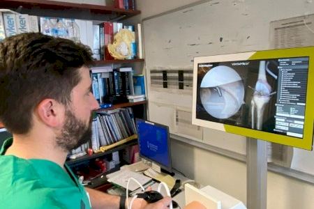El hospital de Torrevieja es pionero en la Comunitat en utilizar un navegador de vanguardia para la realización de osteotomías de rodilla