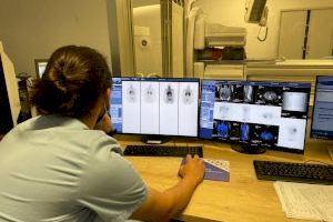 El Hospital Universitario del Vinalopó incorpora un SPECT-TAC en Medicina Nuclear dentro del proceso de renovación tecnológica