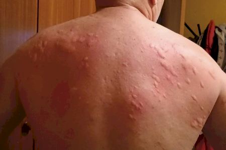 VÍDEO | Els mosquits ja piquen a Castelló: L'aigua i la calor acceleren la plaga