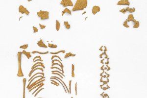 Esqueleto de un niño con síndrome de Down que murió en torno a las 26 semanas de edad gestacional (Autor: J.L. Larrión, Gobierno de Navarra)