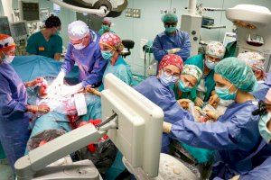 Operació pionera en La Fe de València: extrauen un tumor a un bebé en la setmana 28 de gestació