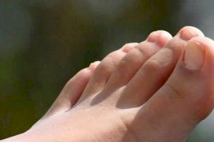 ¿Tienes el dedo gordo del pie mas corto que el siguiente? Los podólogos valencianos advierten del riesgo que puede esconder