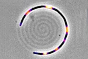 Hallan en bacterias ‘E. coli’ un mecanismo clave para comprender la resistencia a antibióticos