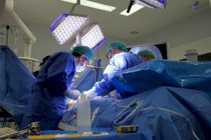 Cirurgians valencians aconsegueixen extraure una costella amb una sola incisió gràcies a una tècnica pionera - (foto 4)