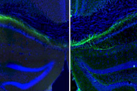 Un circuit cerebral connecta tots dos hemisferis per coordinar la memòria espacial