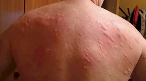 Los mosquitos ya pican en Castellón: El agua y el calor aceleran la plaga